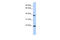 Proteasome Subunit Beta 2 antibody, 27-087, ProSci, Enzyme Linked Immunosorbent Assay image 