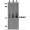 X-Linked Inhibitor Of Apoptosis antibody, TA306170, Origene, Western Blot image 