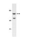 AKT Serine/Threonine Kinase 3 antibody, LS-B8718, Lifespan Biosciences, Western Blot image 