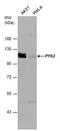 Protein Tyrosine Kinase 2 Beta antibody, PA5-77977, Invitrogen Antibodies, Western Blot image 