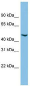 Chromosome 17 Open Reading Frame 75 antibody, TA344684, Origene, Western Blot image 