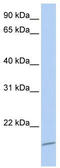 Achaete-Scute Family BHLH Transcription Factor 4 antibody, TA339845, Origene, Western Blot image 