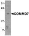 COMM Domain Containing 7 antibody, A09709, Boster Biological Technology, Western Blot image 