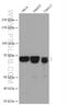 Chromatin Assembly Factor 1 Subunit B antibody, 27633-1-AP, Proteintech Group, Western Blot image 