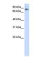 Transmembrane And Coiled-Coil Domains 3 antibody, NBP1-69596, Novus Biologicals, Western Blot image 