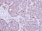 Replication Protein A1 antibody, NBP2-20206, Novus Biologicals, Immunohistochemistry paraffin image 