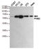 Pyruvate Kinase M1/2 antibody, STJ99145, St John