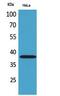Killer cell immunoglobulin-like receptor 2DL3 antibody, STJ96772, St John