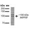 OCRL Inositol Polyphosphate-5-Phosphatase antibody, MA5-27672, Invitrogen Antibodies, Western Blot image 