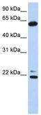 Chaperonin Containing TCP1 Subunit 5 antibody, TA334425, Origene, Western Blot image 