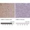 CaM Kinase Like Vesicle Associated antibody, NBP1-82660, Novus Biologicals, Immunohistochemistry paraffin image 