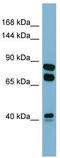 Peroxidasin antibody, TA346463, Origene, Western Blot image 