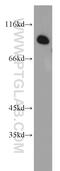 Cell Cycle Progression 1 antibody, 13861-1-AP, Proteintech Group, Western Blot image 