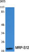 Mitochondrial Ribosomal Protein S12 antibody, GTX34089, GeneTex, Western Blot image 