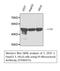 Fumarate Hydratase antibody, STJ96975, St John