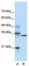 Class B basic helix-loop-helix protein 42 antibody, TA339528, Origene, Western Blot image 