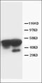 Cyclin A2 antibody, orb18210, Biorbyt, Western Blot image 
