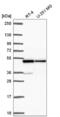 Heterogeneous Nuclear Ribonucleoprotein F antibody, NBP2-57442, Novus Biologicals, Western Blot image 