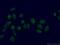 ATM Serine/Threonine Kinase antibody, 27156-1-AP, Proteintech Group, Immunofluorescence image 