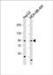 Oligophrenin 1 antibody, PA5-72288, Invitrogen Antibodies, Western Blot image 