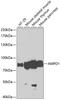 Adenosine Monophosphate Deaminase 1 antibody, A04209, Boster Biological Technology, Western Blot image 