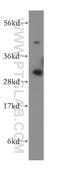 SURF1 Cytochrome C Oxidase Assembly Factor antibody, 15379-1-AP, Proteintech Group, Western Blot image 
