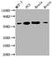 Lysyl Oxidase Like 2 antibody, CSB-RA907007A0HU, Cusabio, Western Blot image 