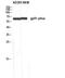 Cytochrome B-245 Beta Chain antibody, STJ93309, St John