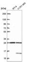 TBC1 Domain Family Member 16 antibody, NBP2-57468, Novus Biologicals, Western Blot image 