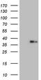 Galectin 9 antibody, LS-C339665, Lifespan Biosciences, Western Blot image 