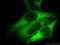 Vasodilator Stimulated Phosphoprotein antibody, 13472-1-AP, Proteintech Group, Immunofluorescence image 