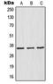 NFKB Inhibitor Alpha antibody, MBS821662, MyBioSource, Western Blot image 