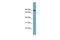 Solute Carrier Family 6 Member 14 antibody, GTX46822, GeneTex, Western Blot image 