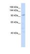 NODAL Modulator 1 antibody, NBP1-79565, Novus Biologicals, Western Blot image 
