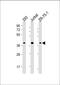 Hypoxia Inducible Factor 1 Subunit Alpha Inhibitor antibody, M02116-1, Boster Biological Technology, Western Blot image 