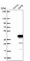Small Glutamine Rich Tetratricopeptide Repeat Containing Beta antibody, NBP1-92385, Novus Biologicals, Western Blot image 