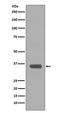 Apolipoprotein E antibody, M00015, Boster Biological Technology, Western Blot image 