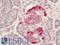 Aspartate Beta-Hydroxylase antibody, LS-C317572, Lifespan Biosciences, Immunohistochemistry paraffin image 