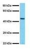 Transcription factor SOX-5 antibody, GTX46041, GeneTex, Western Blot image 