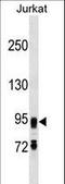 FIG4 Phosphoinositide 5-Phosphatase antibody, LS-C159657, Lifespan Biosciences, Western Blot image 