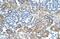 Solute Carrier Family 38 Member 4 antibody, NBP1-55228, Novus Biologicals, Immunohistochemistry paraffin image 