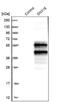 Sorting Nexin 16 antibody, NBP1-85974, Novus Biologicals, Western Blot image 