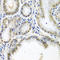 SSX2A antibody, LS-C334977, Lifespan Biosciences, Immunohistochemistry paraffin image 