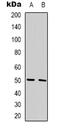 Integral membrane protein GPR180 antibody, abx133786, Abbexa, Western Blot image 