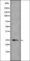2'-5'-Oligoadenylate Synthetase 1 antibody, orb336816, Biorbyt, Western Blot image 