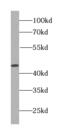 Mitogen-Activated Protein Kinase Kinase 4 antibody, FNab05116, FineTest, Western Blot image 
