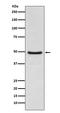 Nuclear Receptor Subfamily 1 Group H Member 3 antibody, M03331, Boster Biological Technology, Western Blot image 