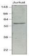 Interferon Regulatory Factor 7 antibody, NBP1-04309, Novus Biologicals, Western Blot image 