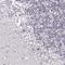Actin Like 6B antibody, NBP1-91648, Novus Biologicals, Immunohistochemistry paraffin image 