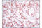 c-met antibody, 8198P, Cell Signaling Technology, Immunohistochemistry paraffin image 